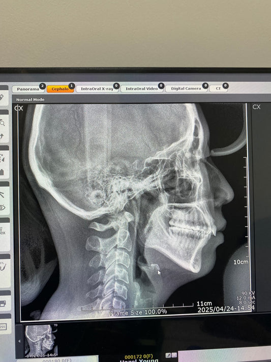 Cephalometric X-ray