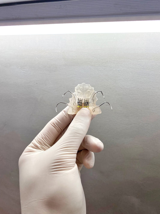 Orthodontic appliances for teeth alignment at Easethetic Dental Lounge in Quezon City