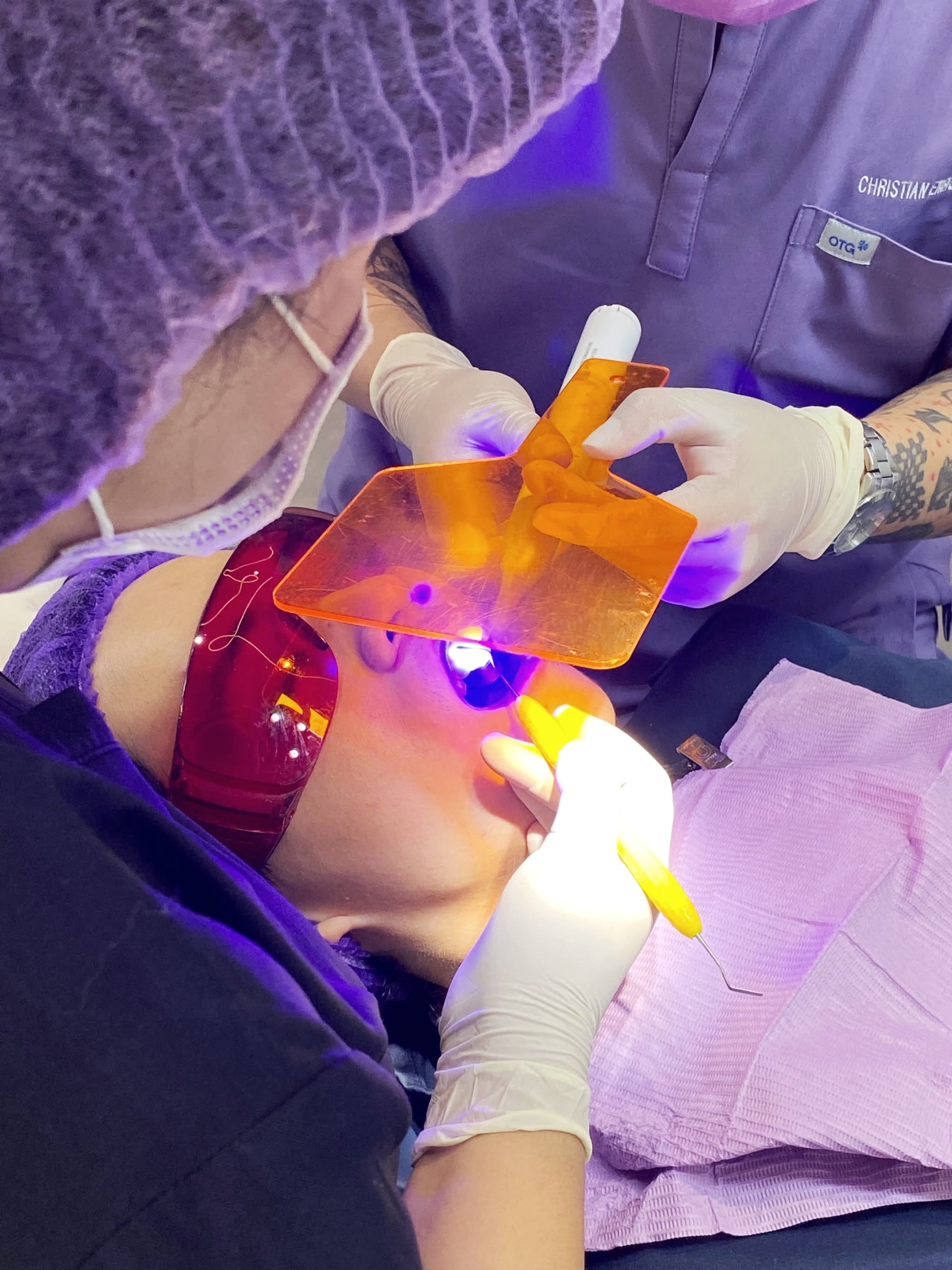 Tooth restoration (pasta filling) procedure at Easethetic Dental Lounge in Quezon City for cavity repair using composite materials