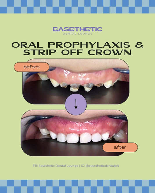 Strip of Crown