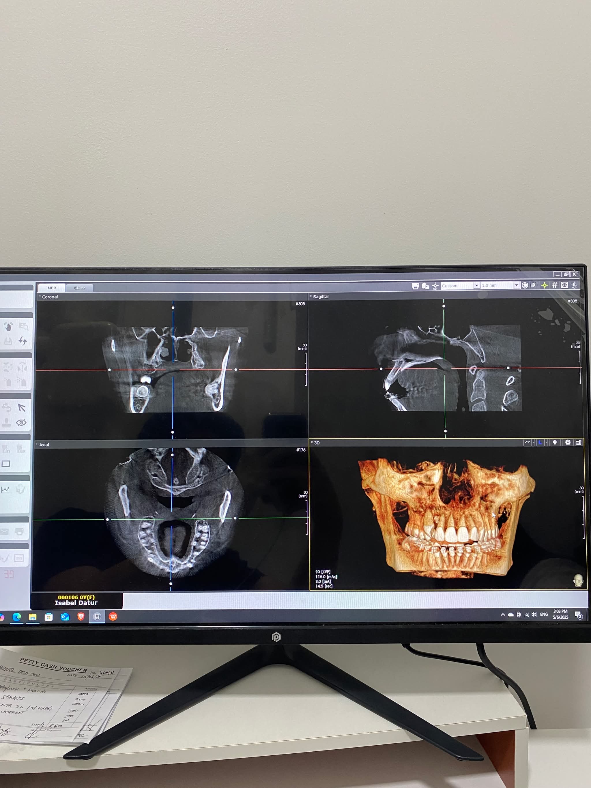 Cbct Scan CBCT Scan | 3D Dental Imaging | QC Dental – Easethetic Dental Lounge